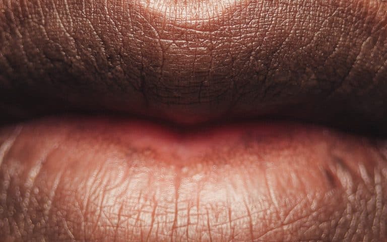 Why Does Marijuana Cause Dry Mouth