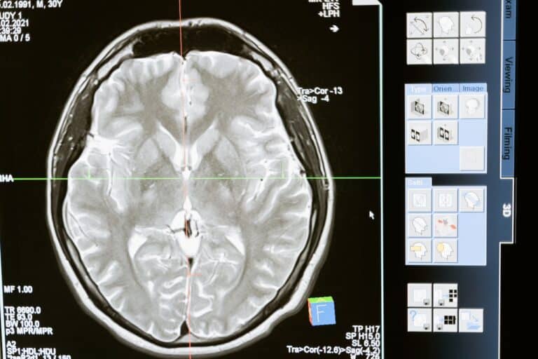 cannabis interaction with brain
